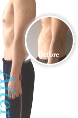 2か月で-4kg~6kgの実績多数!